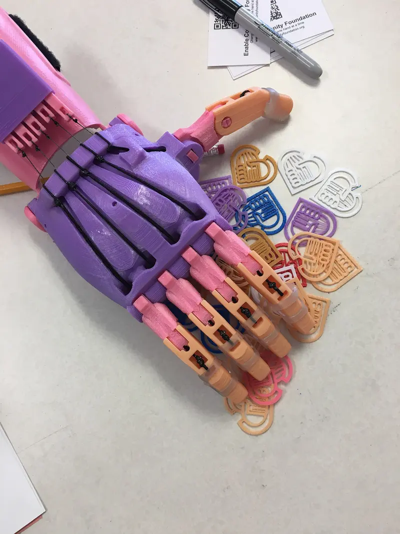 3D printed prosthetic device, near Shallotte